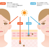 紫外線による肌への影響