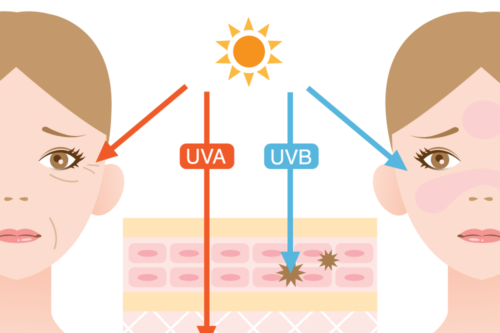 紫外線による肌への影響