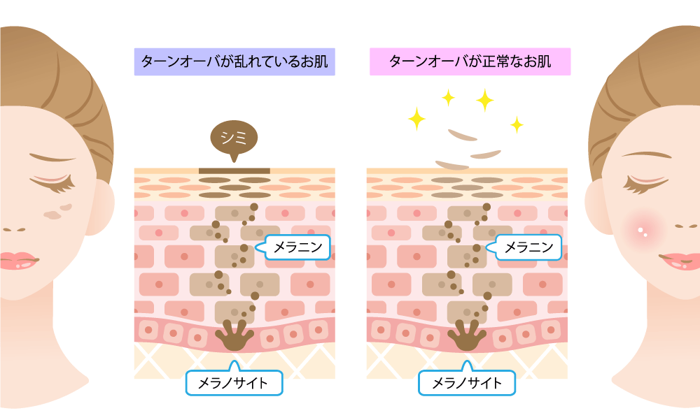 肌のターンオーバー